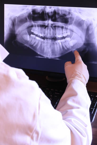 Best Emergency Treatment for Toothache in Moss Point, MS