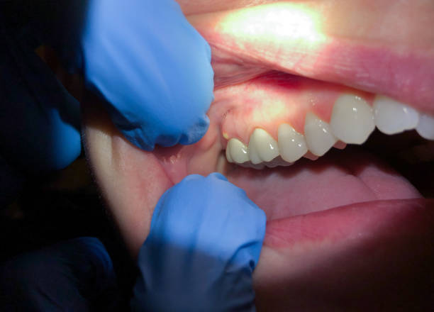 Best Pediatric Emergency Dentist in Moss Point, MS