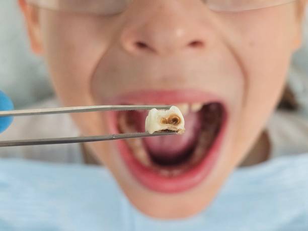 Best Emergency Dental Care for Trauma or Injury in Moss Point, MS